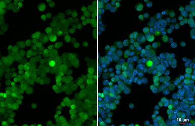 Anti-IRF4 / MUM1 antibody [HL5982] used in Immunocytochemistry/ Immunofluorescence (ICC/IF). GTX647596
